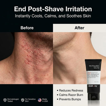 after Shave Balm for Men, Cooling & Hydrating Lotion with Vitamins A, C & E, Aloe Vera & Botanical Extracts, 3 Fl Oz, Aftershave Soothes, Moisturizes & Nourishes Skin, Reduces Razor Burn